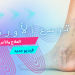 توسع الأوردة