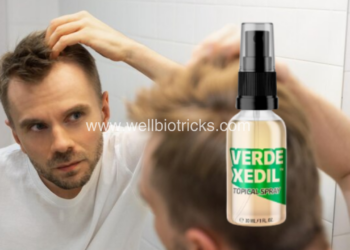 Verdexedil Befehl